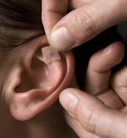 acupunctura in ureche pentru slabit dieta de slabire cu tarate de grau
